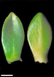 Veronica kellowiae. Leaf surfaces, adaxial (left) and abaxial (right). Scale = 1 mm.
 Image: W.M. Malcolm © Te Papa CC-BY-NC 3.0 NZ